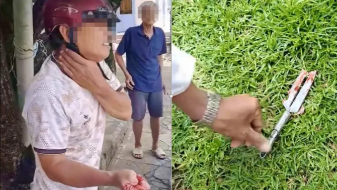 Vụ trấn lột Đồng Nai: Tên cướp lấy cọc tiền xong đâm vào đùi tài xế ô tô, tấn công cả người truy bắt