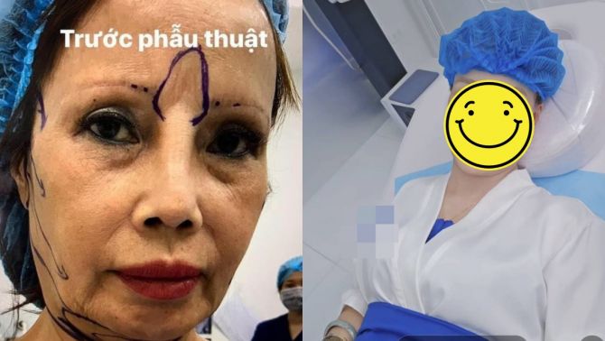 Cô dâu Thu Sao lại lên bàn mổ ở tuổi U70: Diện mạo hậu thẩm mỹ gây tranh cãi dữ dội!