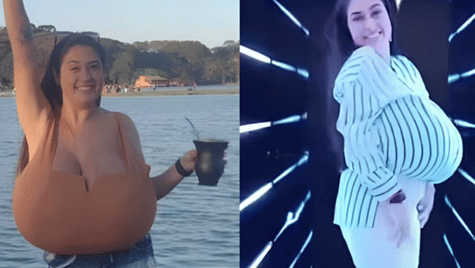 Cuộc sống của cô gái xinh đẹp có vòng 1 nặng đến 12kg: Đưa ra quyết định gây sốc vào năm 22 tuổi