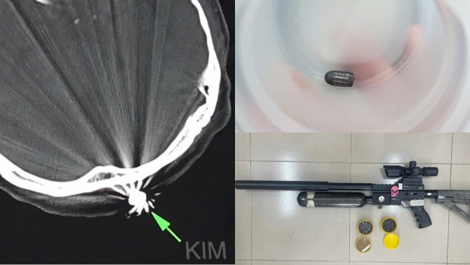 Lời khai của người bắn súng khiến người phụ nữ làm vườn trúng đạn, hé lộ mục đích vác súng ra đường