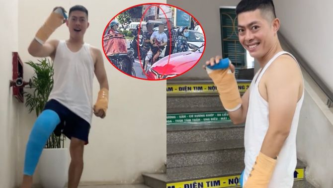 Tiktoker Hà List khoe khoảnh khắc đứng dậy, hành trình phục hồi sau biến cố bị chém lìa tay ở Thái Nguyên