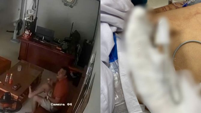 Sau Hà List, nạn nhân bị chém lìa tay ở Hải Phòng được nối lại thần kỳ: Hung thủ là ai?