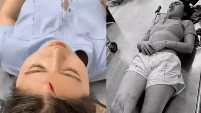 Nóng: Cô gái nhập viện khẩn cấp vì bị ném vợt vào mặt trên sân pickleball, thái độ thủ phạm gây sốc