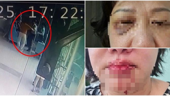 Phẫn nộ vụ việc đôi vợ chồng trẻ hành hung dã man người phụ nữ 60 tuổi tại sảnh chung cư, nguồn cơn chỉ vì điều này