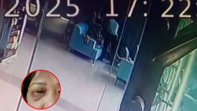 Thêm vụ đánh người ở chung cư, người phụ nữ đang ngồi chơi bất ngờ bị vợ chồng trẻ lao vào hành hung