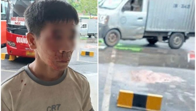 Diễn biến mới vụ phụ xe bị đánh đến nhập viện ở bến Giáp Bát, Hà Nội: Có phải do mâu thuẫn từ trước?