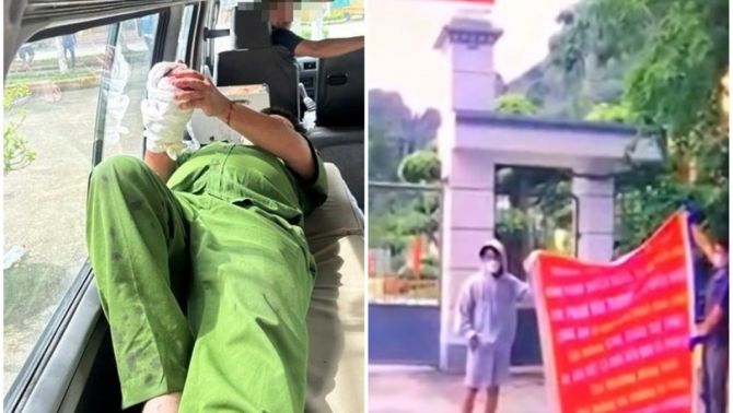 Tình hình sức khỏe cán bộ Công an bị nhóm người gây rối trước Trung tâm cai nghiệm đâm trọng thương