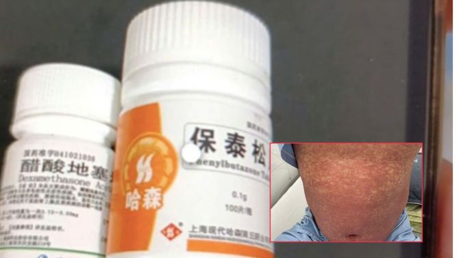 Nguy cơ tử vong từ thuốc trị đau khớp bán tràn lan trên mạng, Bộ Y tế cảnh báo khẩn