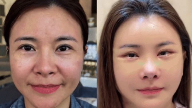 Diễn viên Kim Oanh gây tranh cãi với diện mạo mới sau ca ‘dao kéo’ toàn mặt: Chính chủ lên tiếng đáp trả