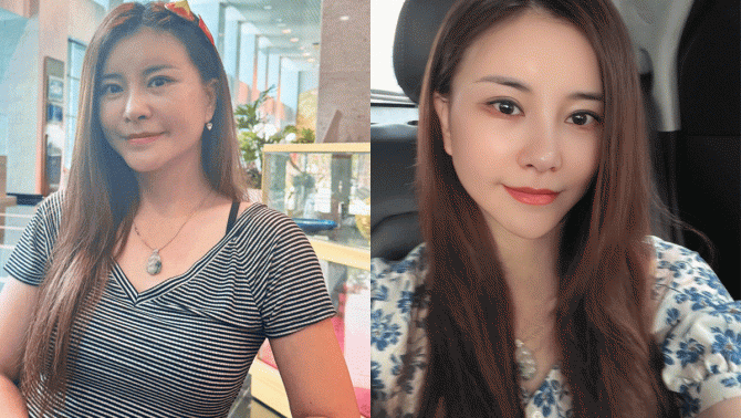 Diễn viên Kim Oanh - ‘vợ anh Núi’ có tuyên bố gây sốt sau khi công khai việc phẫu thuật ở tuổi 50