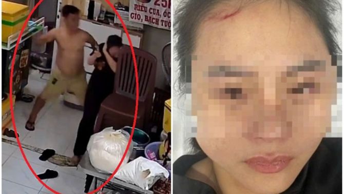 Nguyên nhân khó chấp chấp nhận vụ người phụ nữ bị nam chủ nhà đánh đập dã man tại quán ăn ở TPHCM