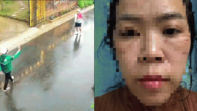 Lâm Đồng: Chi tiết gây phẫn nộ vụ chồng rủ nhóm người chặn đường đánh vợ đến mức phải nhập viện