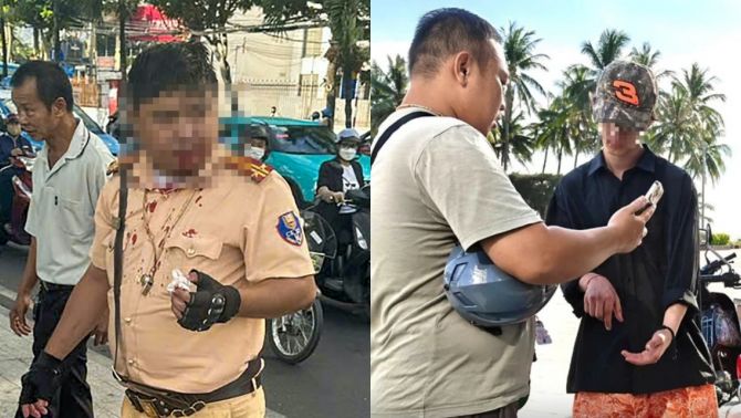 Khởi tố thanh niên ngoại quốc tấn công CSGT ở Nha Trang: Đối diện án phạt nào? 