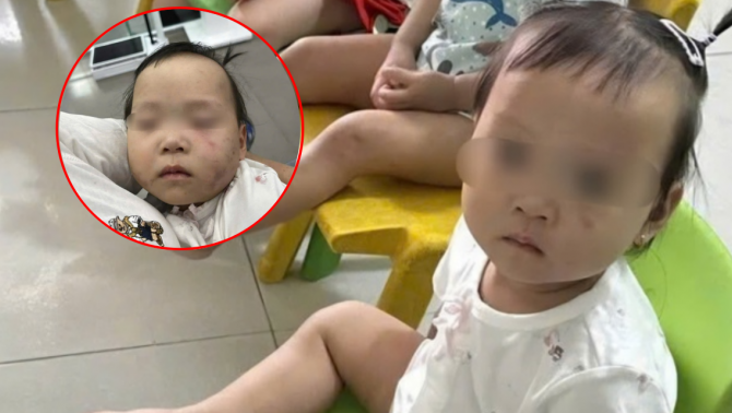 Bắc Ninh: Cô giáo mầm non bạo hành bé 14 tháng tuổi, đối diện án phạt nghiêm khắc nào?