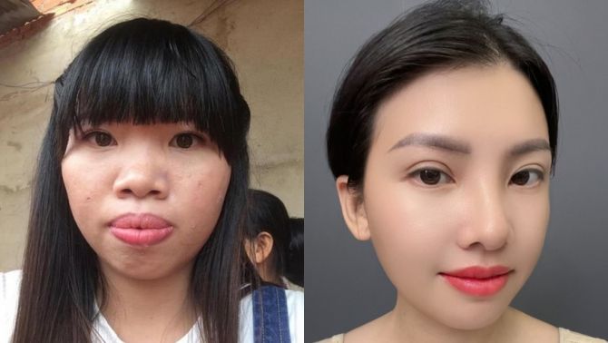 ‘Thị nở tái sinh’ Quách Phượng tiếp tục trùng tu nhan sắc, diện mạo mới thay đổi ngỡ ngàng