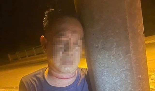 Phát hiện người đàn ông nguy kịch bên trụ điện ở Đắk Lắk, trên cổ có dấu hiệu lạ và tử vong sau đó
