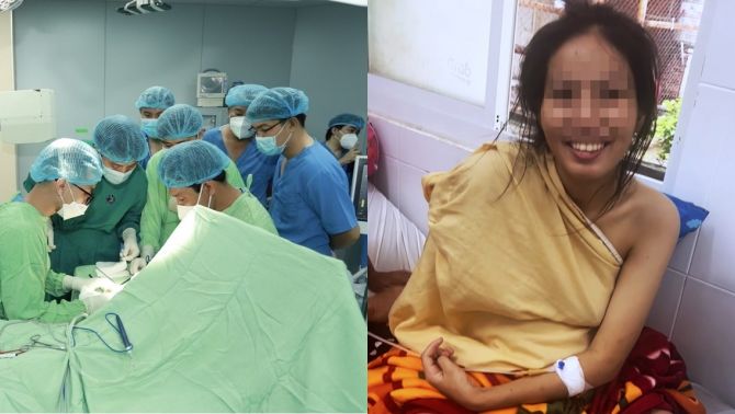 Kỳ tích y học Việt Nam: Thai phụ mang song thai gặp nạn, được bác sĩ ghép tạm tay vào chân chờ ngày nối lại