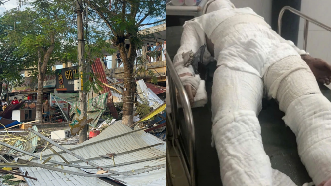 Vụ nổ ở Hải Phòng: Tình hình 5 người bị thương nhập viện, xác định nguyên nhân chính từ quán ăn 