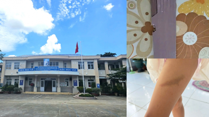 Lộ diễn biến mới vụ phụ huynh TP.HCM tố thầy giáo đánh học sinh lớp 2A: Nhà trường ra quyết định bất ngờ
