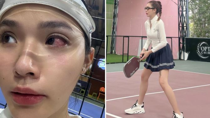 Bị đối thủ nam cố tình đánh bóng pickleball trúng mặt, dàn hot girl đồng lòng nói thẳng cách xử lý