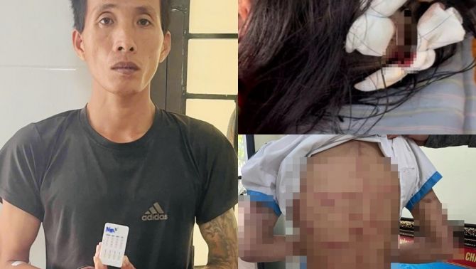 Lời khai khó chấp nhận của cha dượng bạo hành bé gái lớp 5 ở Hà Tĩnh: Nguyên nhân đến từ nhà vợ