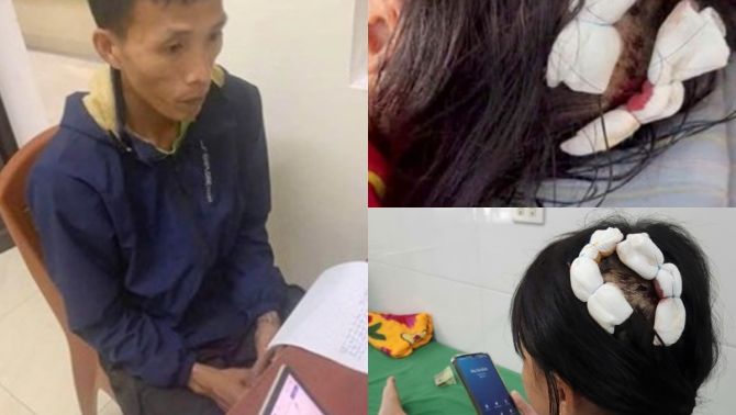 Mức án nặng, có thể kịch khung dành cho gã cha dượng dùng búa bạo hành con riêng của vợ ở Hà Tĩnh