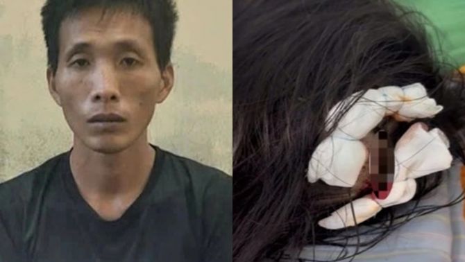 Vụ cha dượng dùng búa đập vào đầu con riêng của vợ: Không chỉ đơn giản là chịu trách nhiệm hình sự!