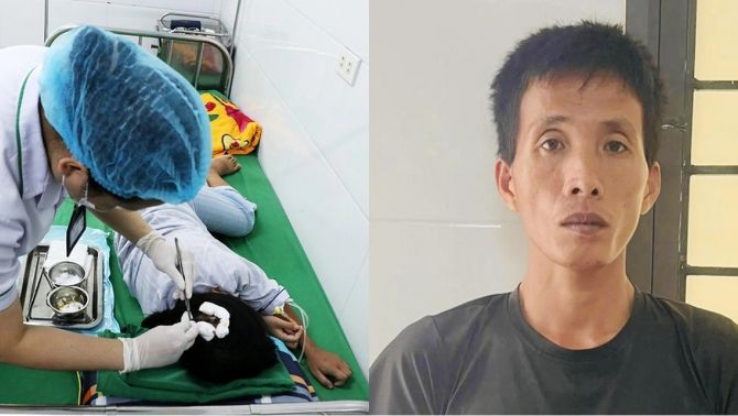 Tình hình bé gái bị cha dượng dùng búa đinh bạo hành sau 1 tuần điều trị, người mẹ quyết định bất ngờ