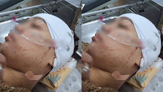 Lời khai của nữ cán bộ phường cầm dao rạch mặt tình địch vì ghen tuông ở Đồng Tháp, gia đình có động thái lạ