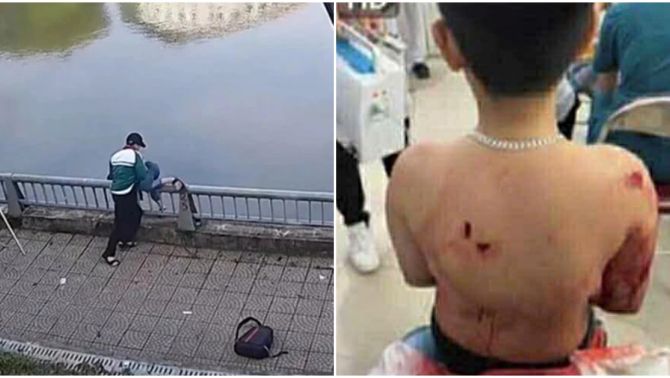 Xôn xao bài viết được cho là của bố nam sinh lớp 8 bị bạn hất xuống hồ nước bức xúc tiết lộ sự thật dã man 