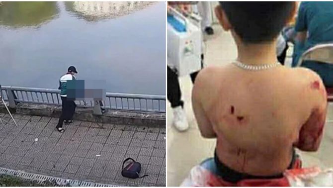 Tình tiết bất ngờ vụ nam sinh lớp 8 bị bạn ném xuống hồ, hé lộ mối quan hệ của cả 2, nạn nhân sợ hãi khi nhắc tên bạn 
