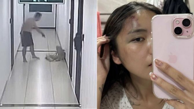 Diễn biến mới vụ chồng đánh vợ thủng màng nhĩ, chấn động não ngay trước mắt hàng xóm ở Hà Nội