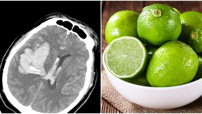 Chồng đột quỵ trong nhà vệ sinh, vợ nhanh chóng làm 1 việc để ‘cầu may’ khiến chồng thêm nguy kịch