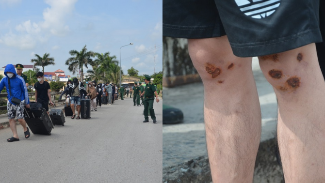 Ám ảnh lời kể từ những nạn nhân trở về sau chiêu trò 'việc nhẹ, lương cao'