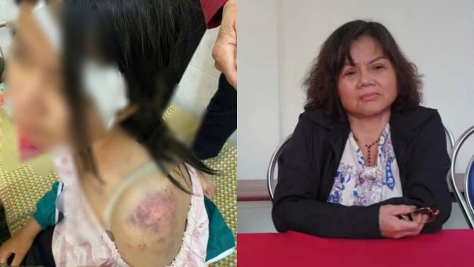 Lý lịch bất hảo của bà nội và 2 người đàn ông hành hạ bé gái 12 tuổi ở Thái Nguyên: Sức khỏe nạn nhân hiện ra sao?