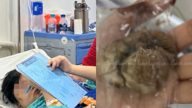 Lời kể ám ảnh của cô gái 22 tuổi trở về từ cõi chết tại khu 'Tam Thái Tử' ở Campuchia