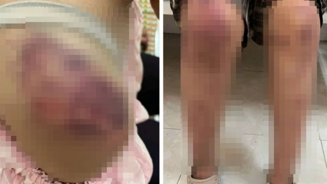 Vụ cháu bé 13 tuổi bị ông bà nội hành hạ dã man ở Thái Nguyên: Mức án nặng đang chờ các đối tượng?