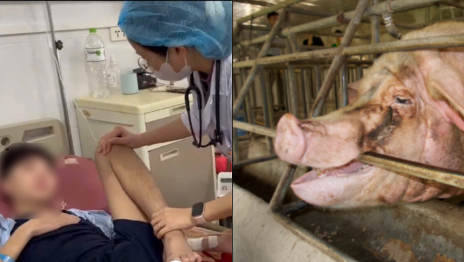 Tình hình sức khỏe của nam thiếu niên bị lợn cắn tại Sơn La sau 1 tháng điều trị 