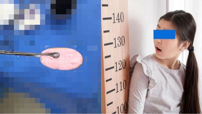 TP.HCM: Bé gái 12 tuổi cấp cứu vì nhét cục xà bông vào ‘nơi riêng tư’, bác sĩ cảnh báo khẩn