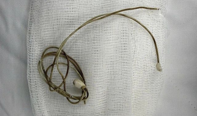 Nam sinh 16 tuổi làm theo video độc hại trên mạng, đưa dây sạc điện thoại vào niệu đạo để tìm ‘cảm giác lạ’