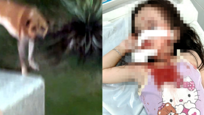 Bé gái 4 tuổi bị chó thả rông tấn công rách mặt: Chính quyền địa phương nói gì?