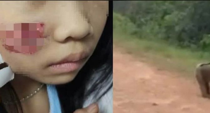 Con khỉ hoang ở Quảng Bình tấn công 5 người: Cháu bé 7 tuổi phải nhập viện với nhiều vết thương