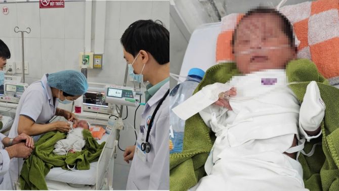 Tình trạng và cuộc sống hiện tại của bé gái bị vùi lấp ở vườn cao su Gia Lai: Thông tin kết quả tìm người thân 