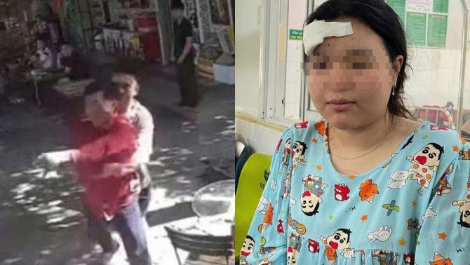 Cô gái nhập viện khâu 4 mũi sau khi nhắc nhở người đàn ông ‘đá lông nheo’ bất lịch sự