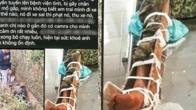 Thực hư thông tin CSGT đạp người dân gãy chân ở Đắk Lắk: CSGT Đắk Lắk thông báo khẩn