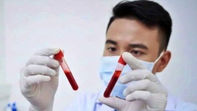 BÁO ĐỘNG: TP.HCM ghi nhận hơn 3.100 ca HIV mới trong vòng một năm, nhóm 15-29 tuổi chiếm tỷ lệ cao nhất