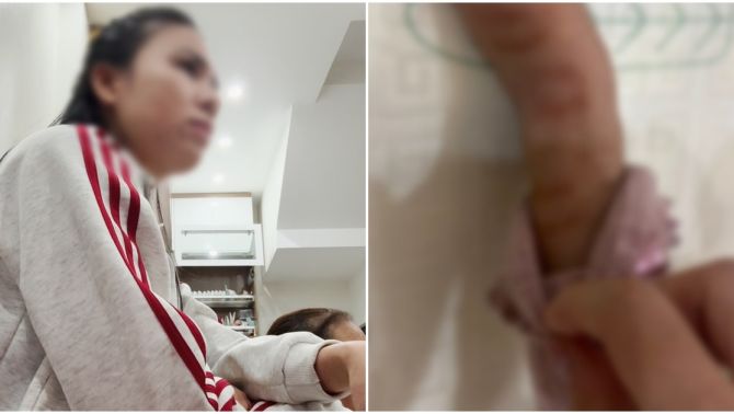 Phẫn nộ lý do không thể chấp nhận của cô giáo mầm non nghi tương tác trẻ tím tái tay chân không thể đi lại