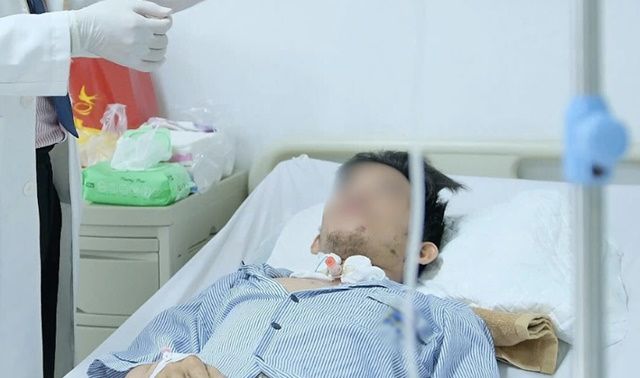 Gặp sự số thang máy kinh hoàng, nam thanh niên 28 tuổi ở Tây Ninh nguy kịch