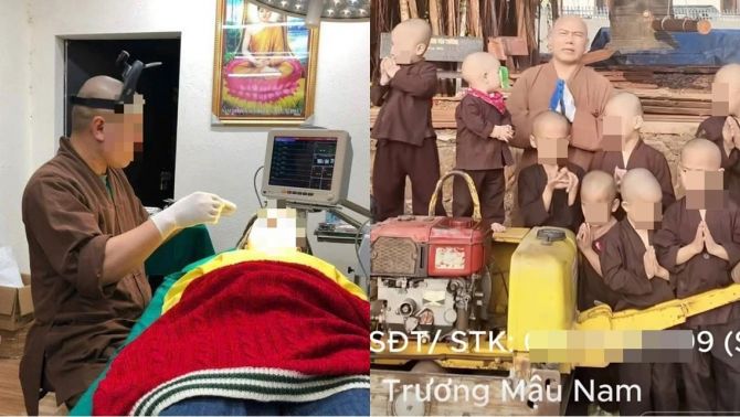 Sự thật về hình ảnh trụ trì chùa Cẩm La nâng mũi, làm răng sứ cho người dân, chính quyền yêu cầu nóng