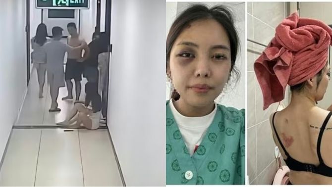 Chồng kéo lê đánh vợ dã man ở chung cư: Giám định 0% tổn thương, công an phường không nhận được đơn